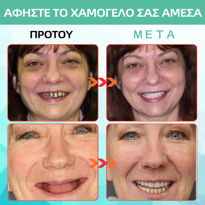 𝐁𝐢𝐤𝐞𝐧𝐝𝐚™ 𝐒𝐢𝐥𝐢𝐜𝐨𝐧𝐞 𝐑𝐞𝐥𝐢𝐧𝐞 𝐃𝐞𝐧𝐭𝐮𝐫𝐞 𝐒𝐞𝐭 (🦷limited offer of 80% - Last 30 minutes🦷)⚕️